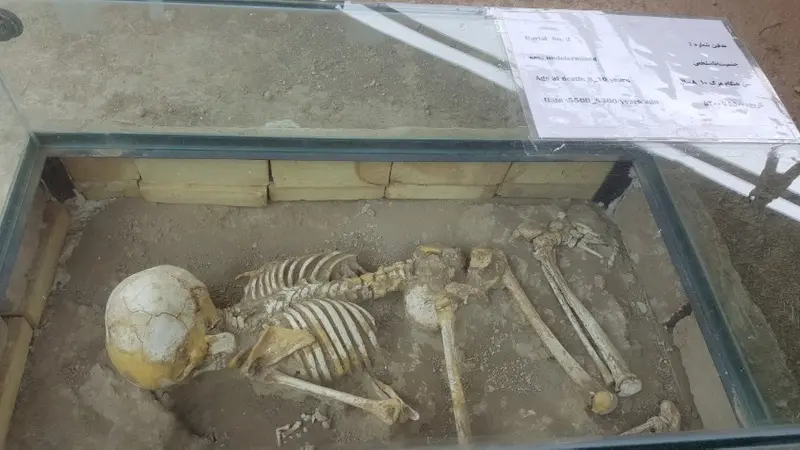 body-bone-skeleton-in-sialk